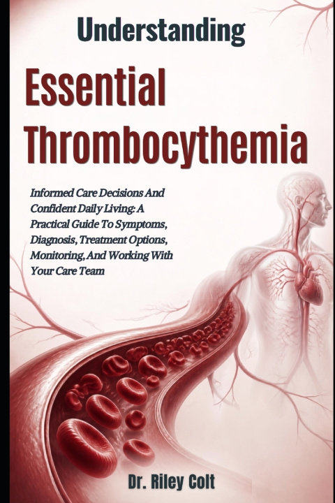 Knjiga Understanding Essential Thrombocythemia Dr. Riley Colt