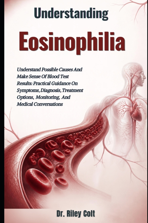 Knjiga Understanding Eosinophilia Dr. Riley Colt