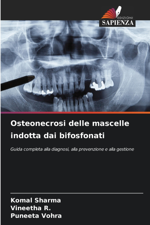 Buch Osteonecrosi delle mascelle indotta dai bifosfonati Komal Sharma