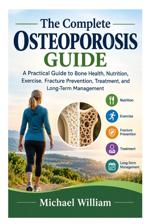 Buch The Complete Osteoporosis Guide Michael William