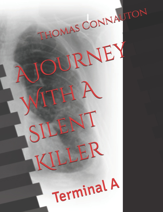 Książka A Journey With A Silent Killer Thomas Connauton