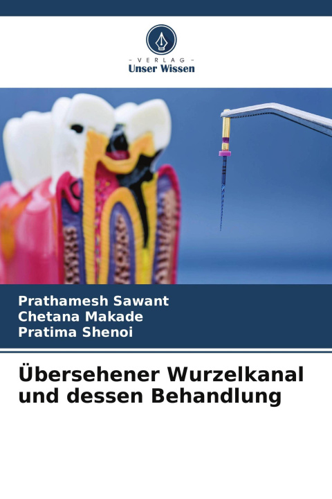 Livro Übersehener Wurzelkanal und dessen Behandlung Chetana Makade