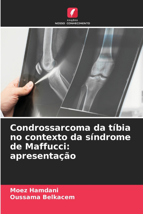 Boek Condrossarcoma da tíbia no contexto da síndrome de Maffucci Moez Hamdani