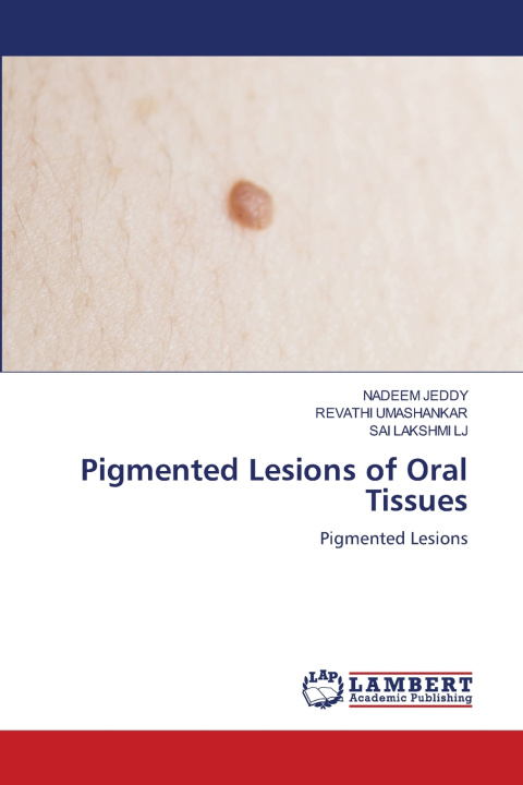 Buch Pigmented Lesions of Oral Tissues Nadeem Jeddy