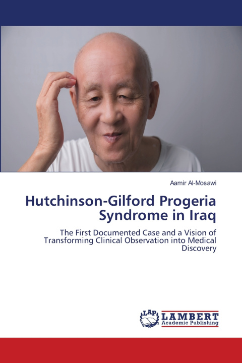 Libro Hutchinson-Gilford Progeria Syndrome in Iraq Aamir Al-Mosawi