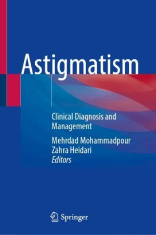 Kniha Astigmatism Mehrdad Mohammadpour