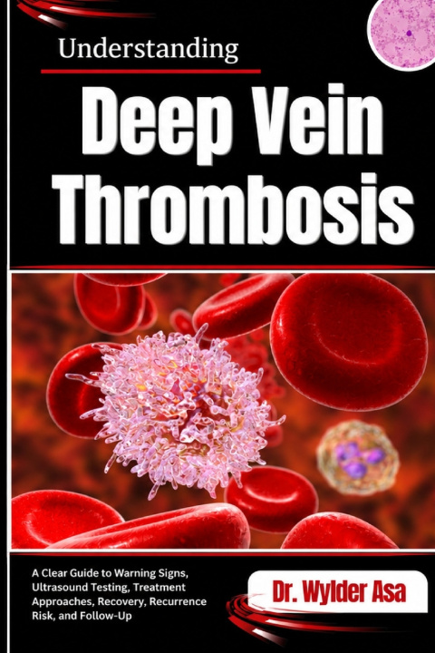 Βιβλίο Understanding Deep Vein Thrombosis Dr. Wylder Asa