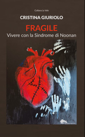Boek Fragile. Vivere con la Sindrome di Noonan Cristina Giuriolo