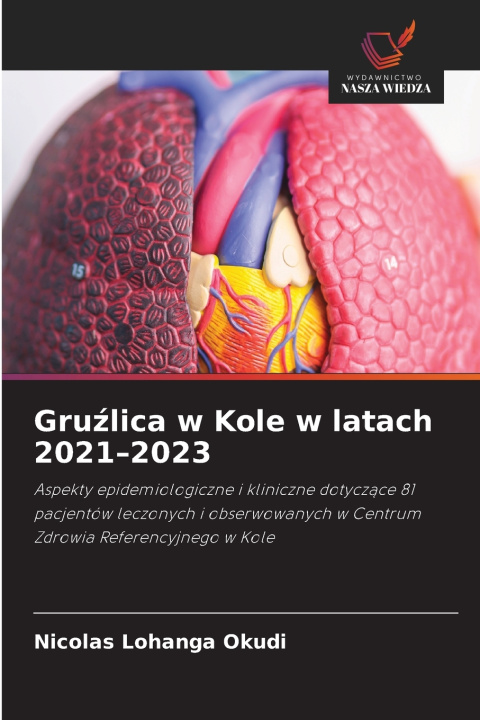 Könyv Gruźlica w Kole w latach 2021-2023 Nicolas Lohanga Okudi