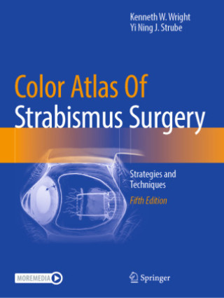 Kniha Color Atlas Of Strabismus Surgery Kenneth W. Wright