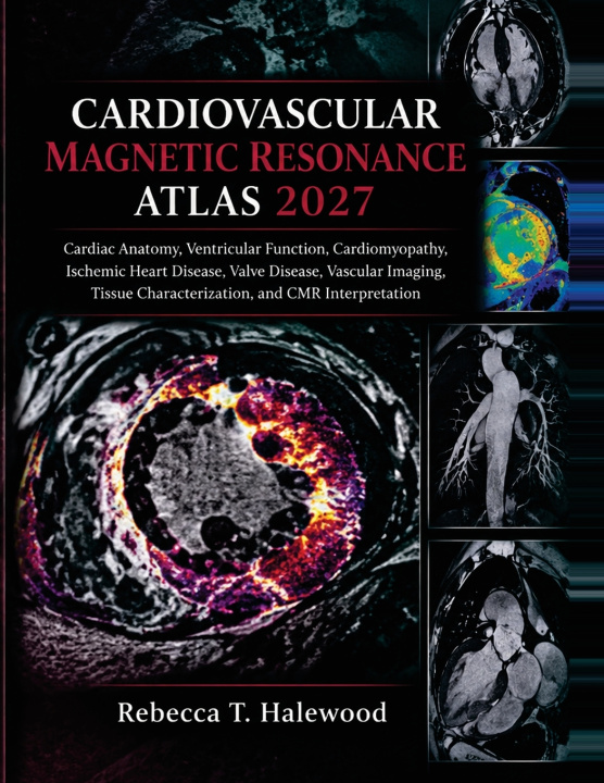 Kniha Cardiovascular Magnetic Resonance Atlas 2027 Rebecca T. Halewood