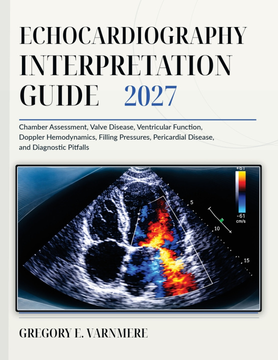 Kniha Echocardiography Interpretation Guide 2027 GREGORY E. VARNMERE